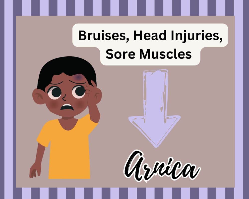 boy with bruised head and arnica